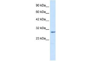 CLIC2 antibody used at 1. (CLIC2 Antikörper  (Middle Region))