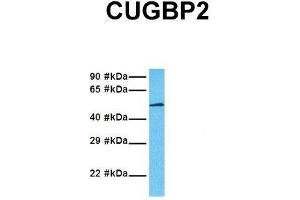 Western Blotting (WB) image for anti-CUGBP, Elav-Like Family Member 2 (CELF2) (N-Term) antibody (ABIN2778745)