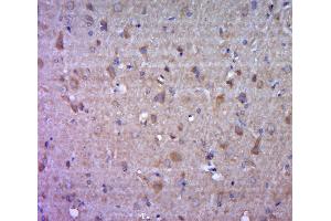 Immunohistochemistry (Paraffin-embedded Sections) (IHC (p)) image for anti-Fascin (FSCN1) (AA 11-110) antibody (ABIN728293)