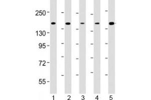 Western blot testing of human 1) K562, 2) Jurkat, 3) HeLa, 4) rat C6 and 5) human MOLT-4 cell lysate with CTCF antibody at 1:4000. (CTCF Antikörper  (AA 445-727))
