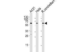 Western blot analysis of lysates from A431, Hela cell line and rat cerebellum tissue lysare(from left to right), using KISS1R Antibody (Center) (ABIN1881480 and ABIN2843217). (KISS1R Antikörper  (AA 235-263))