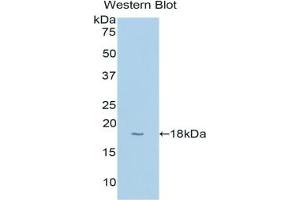 Western blot analysis of the recombinant protein. (CYP1B1 Antikörper  (AA 374-516))