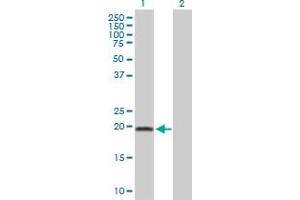 Western Blot analysis of ADI1 expression in transfected 293T cell line by ADI1 MaxPab polyclonal antibody. (ADI1 Antikörper  (AA 1-179))
