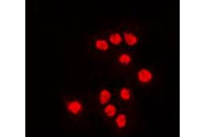 Immunofluorescent analysis of ATF7 staining in Jurkat cells.