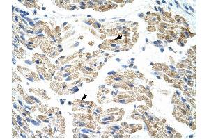 HNRPK antibody was used for immunohistochemistry at a concentration of 4-8 ug/ml to stain Skeletal muscle cells (arrows) in Human Muscle. (HNRNPK Antikörper  (C-Term))