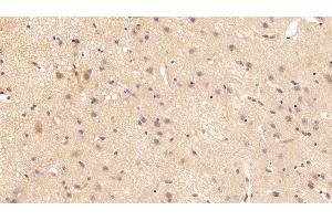 Immunohistochemistry (IHC) image for anti-Gelsolin (GSN) (AA 674-782) antibody (ABIN7442174)
