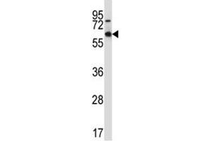 MEF2D antibody western blot analysis in 293 lysate. (MEF2D Antikörper  (AA 251-279))
