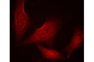 Immunofluorescence staining of methanol-fixed HeLa cells using NF-kappa,B-p65 (phospho-Ser311) antibody.