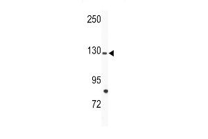 Western blot analysis of anti-TIE Antibody (N-term) (ABIN392060 and ABIN2841825) in mouse bladder tissue lysates (35 μg/lane). (TIE1 Antikörper  (N-Term))