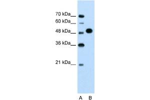 WB Suggested Anti-MKRN1 Antibody Titration:  1. (MKRN1 Antikörper  (N-Term))