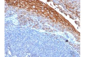Formalin-fixed, paraffin-embedded human Tonsil stained with MUC18 Mouse Recombinant Monoclonal Antibody (rMUC18/1130). (Rekombinanter MCAM Antikörper)