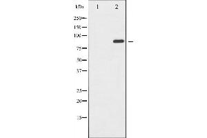 Western blot analysis of GluR2 expression in Mouse brain tissue lysates,The lane on the left is treated with the antigen-specific peptide.