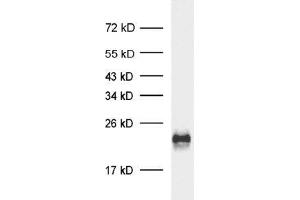 sample: rat retina preperation (ECL) (Complexin 4 Antikörper)