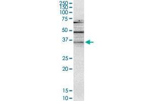 NMNAT2 monoclonal antibody (M02), clone 4E6. (NMNAT2 Antikörper  (AA 208-307))