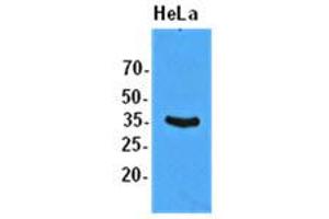 Western Blotting (WB) image for anti-Eukaryotic Translation Initiation Factor 2 Subunit 1 (EIF2S1) antibody (ABIN781544) (EIF2S1 Antikörper)