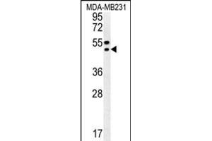 TR Antibody (C-term) (ABIN652176 and ABIN2840578) western blot analysis in MDA-M cell line lysates (35 μg/lane). (TRAM2 Antikörper  (C-Term))