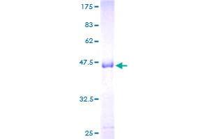 Image no. 1 for Prolactin (PRL) (AA 29-227) protein (GST tag) (ABIN1316316) (Prolactin Protein (PRL) (AA 29-227) (GST tag))
