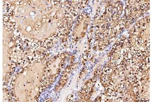 anti-Enolase 1 (ENO1) (AA 50-250) antibody