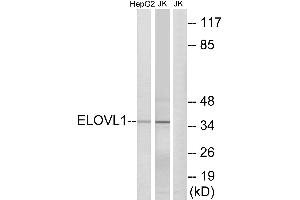 Western blot analysis of extracts from HepG2 cells and Jurkat cells, using ELOVL1 antibody. (ELOVL1 Antikörper  (Internal Region))