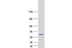 Validation with Western Blot
