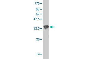 Western Blot detection against Immunogen (37 KDa) . (DLL4 Antikörper  (AA 123-221))