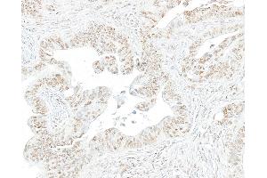 Immunohistochemistry (IHC) image for anti-RNA Polymerase II (pSer2) antibody (ABIN7454655) (RNA Polymerase II Antikörper  (pSer2))