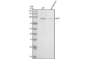Western blot analysis of VAV3 using anti-VAV3 antibody (ABIN7606680).