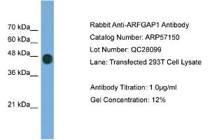 WB Suggested Anti-ARFGAP1  Antibody Titration: 0. (ARFGAP1 Antikörper  (Middle Region))
