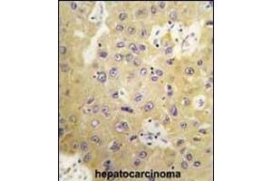 Immunohistochemistry (Paraffin-embedded Sections) (IHC (p)) image for anti-serum/glucocorticoid Regulated Kinase Family, Member 3 (SGK3) (AA 1-30), (N-Term) antibody (ABIN392462)