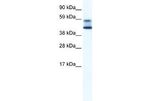 WB Suggested Anti-ZBTB7A Antibody Titration:  5. (ZBTB7A Antikörper  (N-Term))