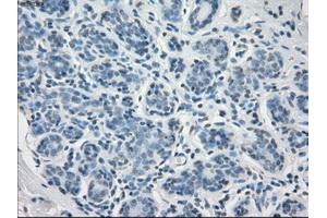Immunohistochemical staining of paraffin-embedded breast tissue using anti-FCGR2A mouse monoclonal antibody. (FCGR2A Antikörper)