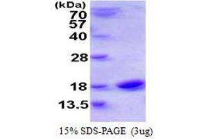 SDS-PAGE (SDS) image for Cystatin SN (CST1) (AA 21-141) protein (His tag) (ABIN667631) (CST1 Protein (AA 21-141) (His tag))