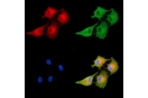 ABIN6263078 and ABIN6278934 staining  cells by IF/ICC.