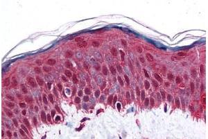 Human Skin: Formalin-Fixed, Paraffin-Embedded (FFPE) (Retinoblastoma Binding Protein 8 Antikörper  (AA 452-747))