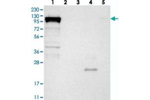 Western blot analysis of Lane 1: RT-4, Lane 2: U-251 MG, Lane 3: Human Plasma, Lane 4: Liver, Lane 5: Tonsil with DHX36 polyclonal antibody  at 1:250-1:500 dilution. (DHX36 Antikörper)