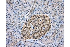 Immunohistochemical staining of paraffin-embedded liver tissue using anti-CAPZA1 mouse monoclonal antibody. (CAPZA1 Antikörper)