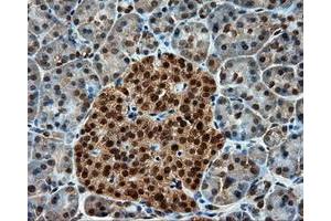 Immunohistochemical staining of paraffin-embedded Kidney tissue using anti-PSMC3 mouse monoclonal antibody. (PSMC3 Antikörper)