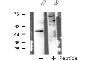 Western blot analysis of extracts from 293 cells, using IP6K3 antibody. (IP6K3 Antikörper  (Internal Region))
