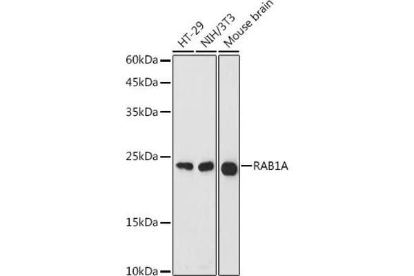 RAB1A anticorps  (AA 1-205)