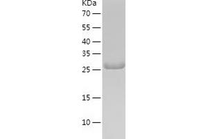 Western Blotting (WB) image for Ribosomal Protein S4, X-Linked (RPS4X) (AA 1-263) protein (His tag) (ABIN7124901) (RPS4X Protein (AA 1-263) (His tag))