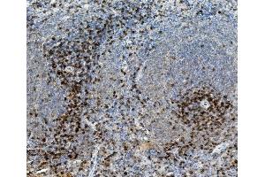 IHC analysis of CD8 alpha/Cd8a using anti-CD8 alpha/Cd8a antibody (ABIN7601570). (CD8 alpha Antikörper  (AA 39-245))