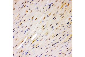 Anti- MSK1 Picoband antibody, IHC(P) IHC(P): Mouse Cardiac Muscle Tissue (MSK1 Antikörper  (AA 540-665))