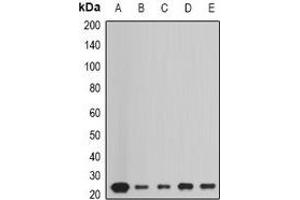 Western blot analysis of Peroxiredoxin 1 expression in HepG2 (A), Hela (B), A549 (C), mouse liver (D), mouse heart (E) whole cell lysates. (Peroxiredoxin 1 Antikörper)