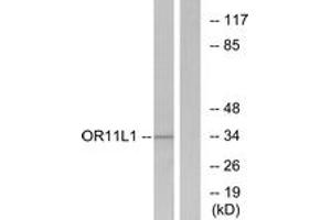 Western blot analysis of extracts from LOVO cells, using OR11L1 Antibody. (OR11L1 Antikörper  (AA 201-250))