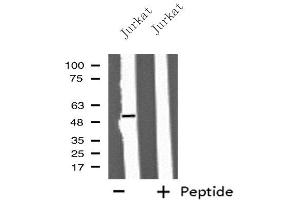 Western blot analysis of extracts from Jurkat cells, using IFIT5 antibody. (IFIT5 Antikörper  (Internal Region))