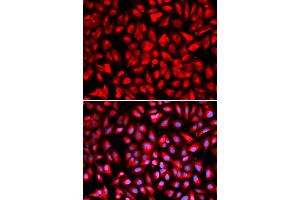 Immunofluorescence analysis of U2OS cells using IPO5 antibody (ABIN5971032). (Importin 5 Antikörper)