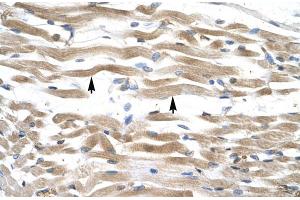 Human Muscle (KIFC2 Antikörper  (N-Term))