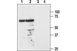 Western blot analysis of mouse (lanes 1 and 3) and rat (lanes 2 and 4) brain lysates: - 1,2. (MC3R Antikörper  (1st Extracellular Loop))