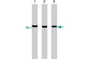 Western blot analysis using MARK3 polyclonal antibody on His-tagged c-tak1 (lane 1), RKO cell lysate (lane 2) and HCT-116 cell lysate (lane 3). (MARK3 Antikörper)