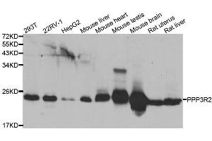 Western blot analysis of extracts of various cell lines, using PPP3R2 antibody. (Calcineurin B Antikörper  (AA 1-173))